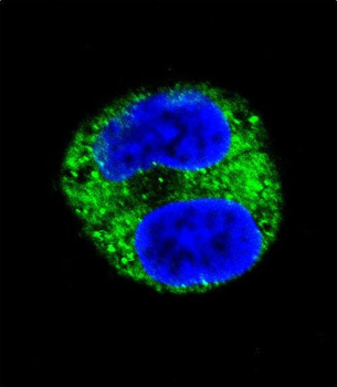TYR Antibody (Center)