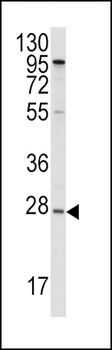 APOA1 Antibody (N-term)