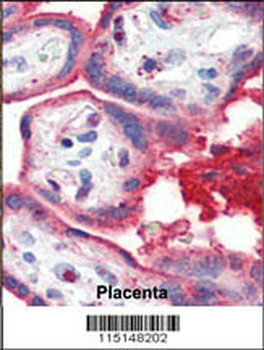 APOA1 Antibody (N-term)