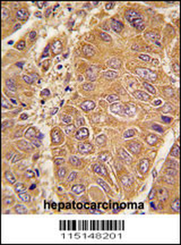 APOA1 Antibody (N-term)