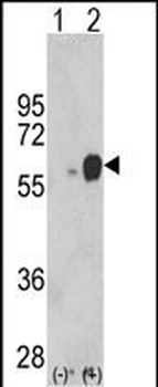 ARSB Antibody (Center)