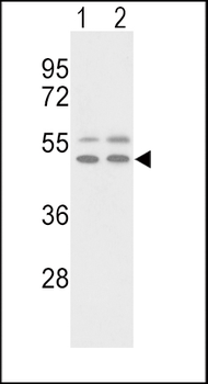VTN Antibody (C-term)