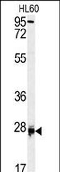 DPT Antibody (Center)