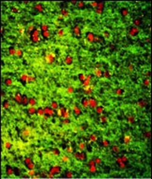 DPT Antibody (Center)