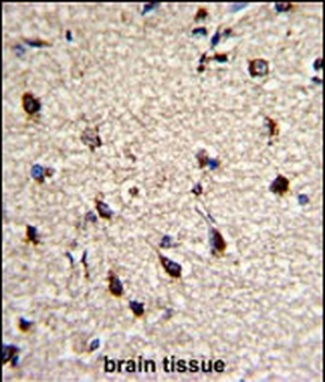 DPT Antibody (Center)