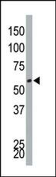 DYRK4 Antibody (C-term)