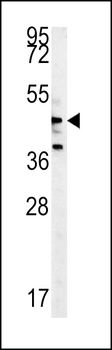 NLK-T286 Antibody (Center)