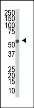 SRPK2 Antibody (C-term)