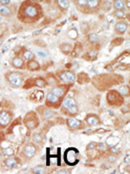 SRPK2 Antibody (C-term)