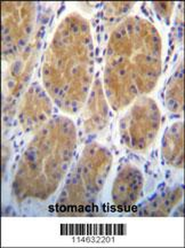 AARS2 Antibody (Center)