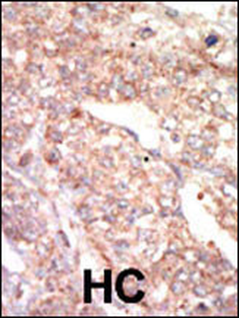 EphA1 Antibody (N-term)