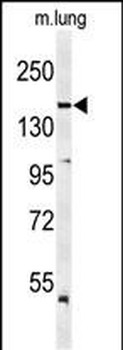 KDR (Y1175) Antibody