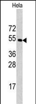 CPE Antibody (C-term)