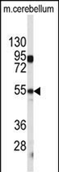 CPE Antibody (C-term)