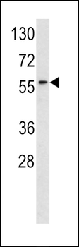 RYK Antibody (Center C397)