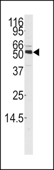 CAMKK1 Antibody (Center)