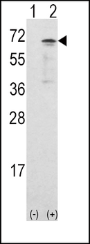 CAMKK1 Antibody (Center)
