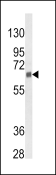 CYP3A5 Antibody (Center)