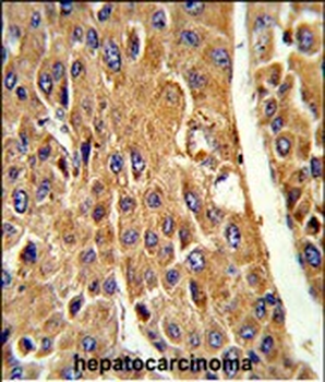 CYP3A5 Antibody (Center)