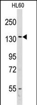 VARS Antibody (Center)