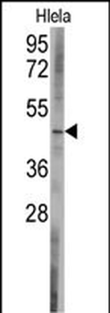 BCL2L13 Antibody (C-term)
