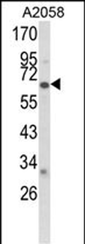 CYP2F1 Antibody (C-term)
