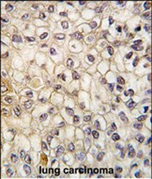 CYP2F1 Antibody (C-term)