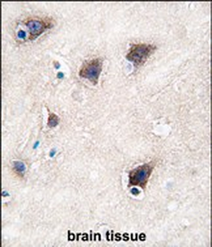 CYP2R1 Antibody (C-term)