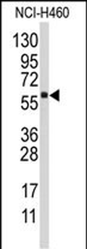 CYP4F12 Antibody (C-term)
