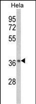 NFKBIA Antibody ( S32/36 )