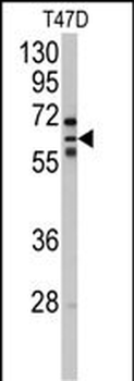 CYP2C8 Antibody (N-term)