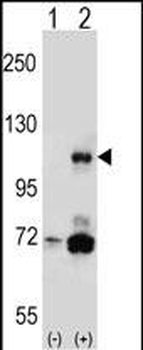 PIK3CB Antibody (N-term S139)