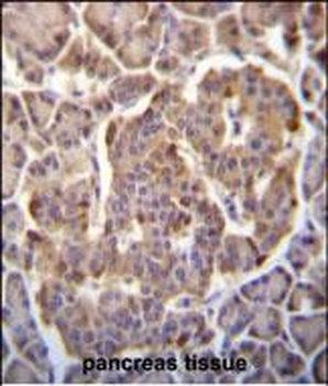 PIK3CB Antibody (N-term S139)