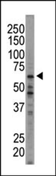 HRI Antibody (N-term)