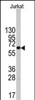 PFKFB1 Antibody (Center)