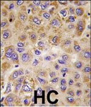 PFKFB1 Antibody (Center)