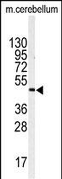 ITPKA Antibody (N-term)