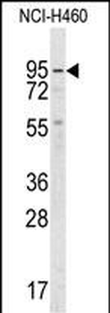 Guanylyl Cyclase alpha 2 (GUCY1A2) Antibody (C-term)