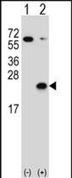 DUSP3 Antibody (C-term)