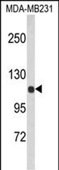 ACTN1 Antibody (N-term)