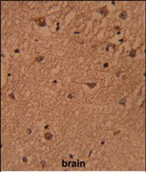 HSPC142 Antibody (Center)