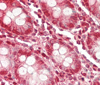 ZMYND11 Antibody (N-term)