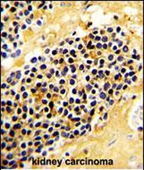 KLRC1 Antibody (C-term)