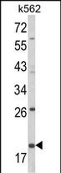 KLRD1 Antibody (N-term)