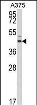 ESRRA Antibody (Center)