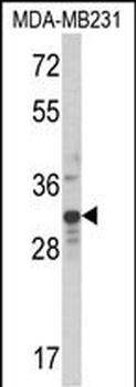 MLX Antibody (Center)