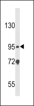 CARD4 Antibody (C-term)
