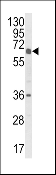 CYP2C18 Antibody (C-term)