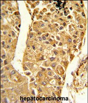 CYP2C18 Antibody (C-term)