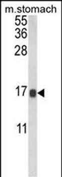 LGALS2 Antibody (Center)